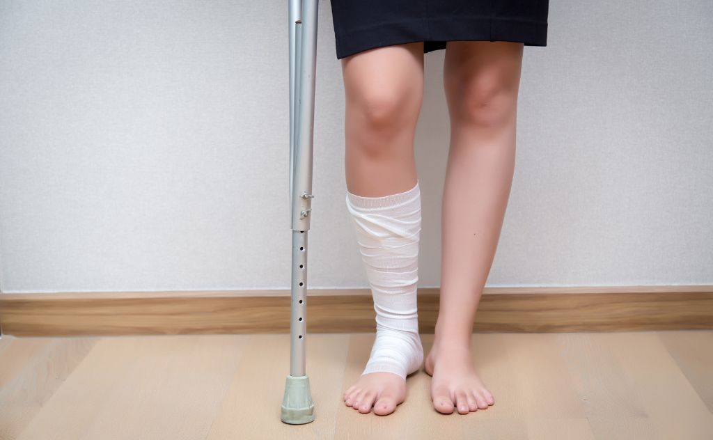 Woman with her foot in a cast using crutches